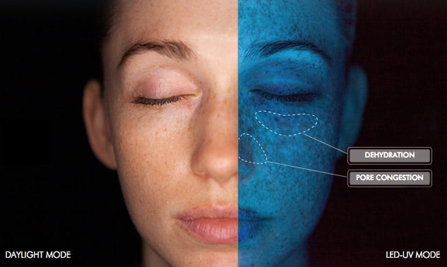 Get a Closer Look at Your Skin with Skinceuticals SkinScope!